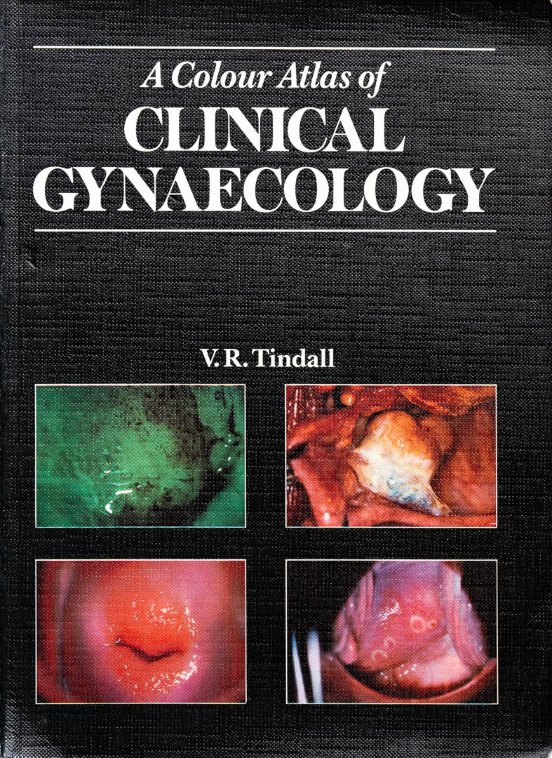 A Colour Atlas of Clinical Gynaecology - Tindall